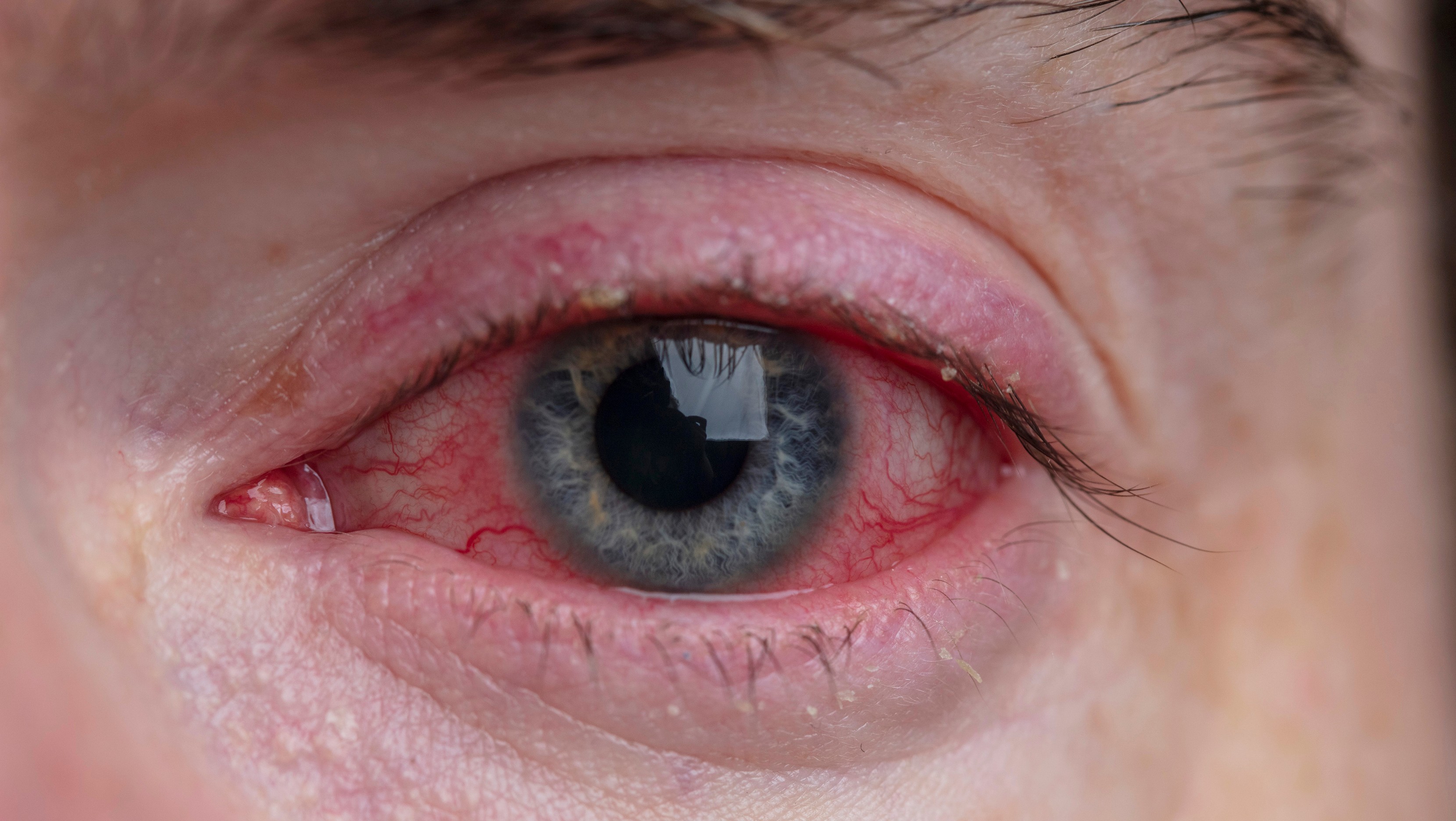 SAĞLIKLI GÖZ MAKYAJININ İPUÇLARI